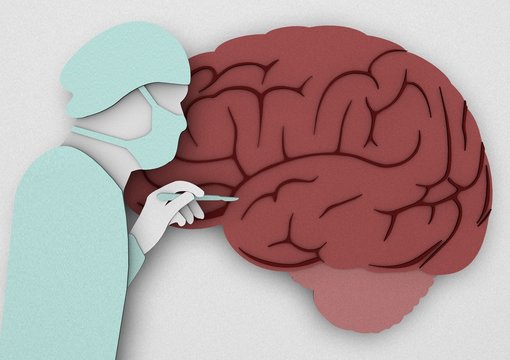 Chirurgo dottore, studio cervello, intervento