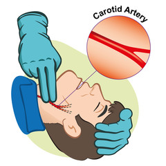 First Aid measuring pulse through the carotid artery, gloves