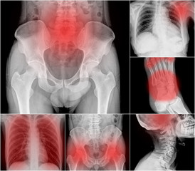 Collection X-ray multiple part of human , painful