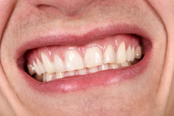 male mouth laughing
