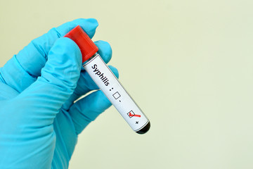 Fototapeta premium Blood sample with syphilis (Treponema Pallidum) positive