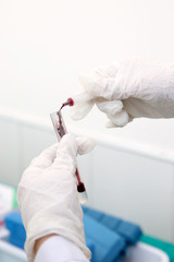 Medical worker running blood test 
