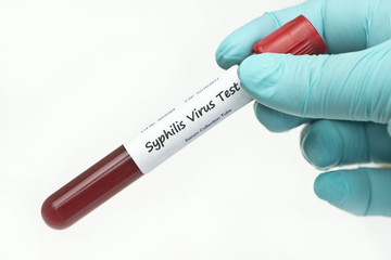 Obraz premium Syphilis Test Panel