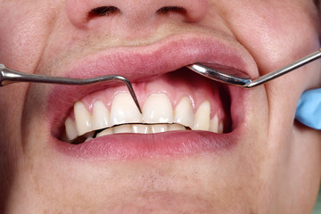 patient having her teeth examined by specialist