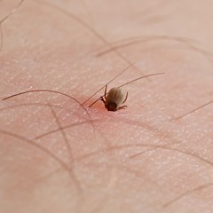 Tick 