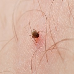 Tick 