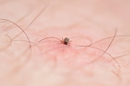 Tick 