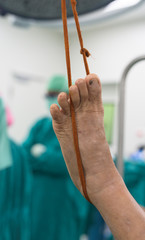 prepare foot before surgery