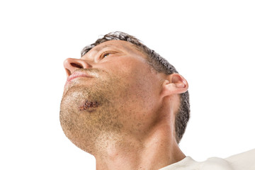 Obraz premium Kinn wurde genäht - Rasieren unmöglich