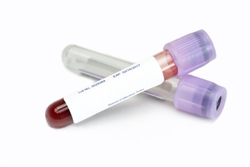 Blood Sample Collection