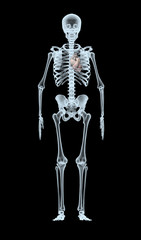 Skeleton X-Ray displaying heart