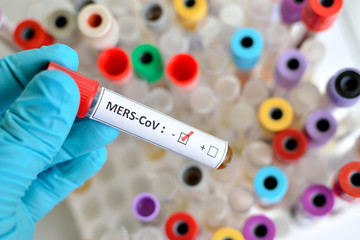 Fototapeta premium Blood sample with MERS-CoV (Middle East respiratory syndrome coronavirus) negative
