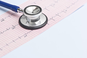 Electrocardiogram