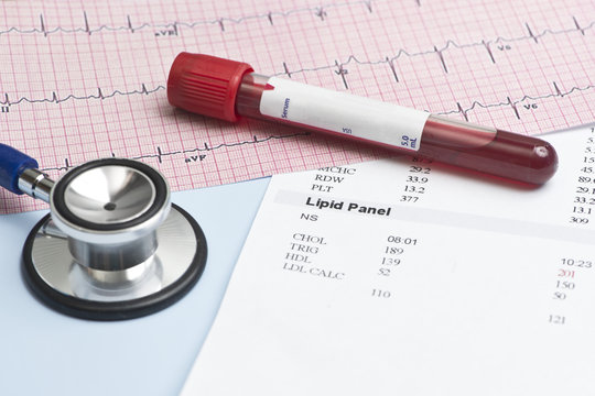 Lipid Panel EKG