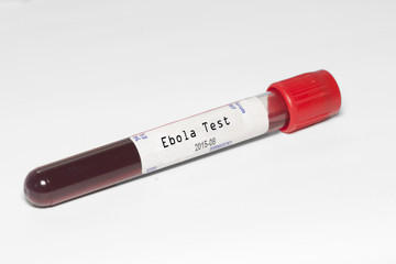 Ebola Test