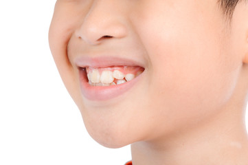 Smile teeth from kid
