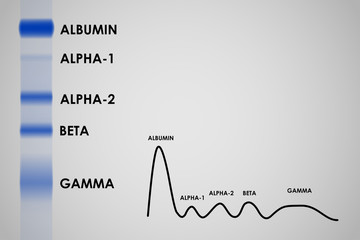 Blood serum protein electrophoresis electrophoretogram