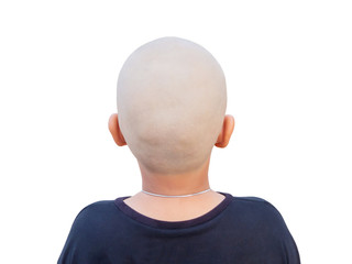 Rear view of Asian boy's bold head isolated