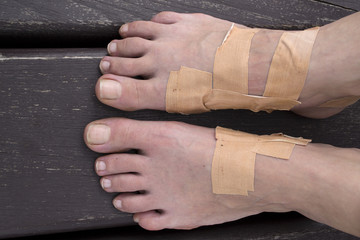Blistrered feet with plaster patches