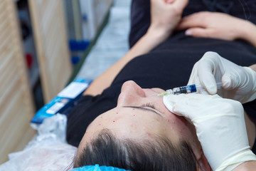 Injections on the face with cosmetic procedures.