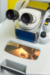 Laser processing for dental prosthesis