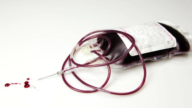 A panning shot of a filled blood bag. Drops of fresh blood
