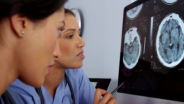 Close up of two female doctors working together on computer brain scans