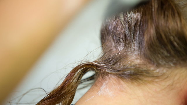 Close Up On Hair Roots Coloring