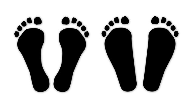 Flat and normal feet - pes planus animation