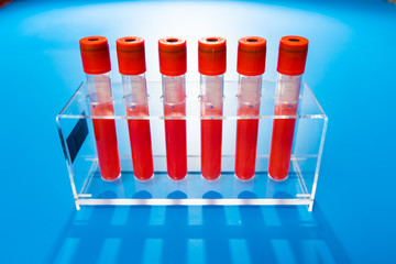 Blood sample in test tube