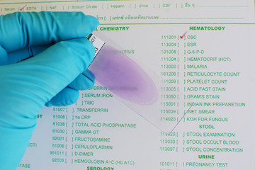 Blood film for malaria parasite and blood cell morphology 