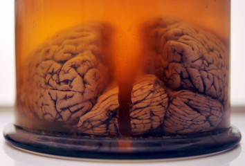 mózg człowieka