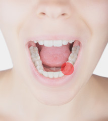 Fototapeta premium Denti donna dolore molare
