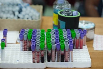Blood samples for the annual health check.