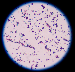 Gram positive cocci,gram stain.