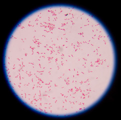 Gram negative bacilli,Gram stain.
