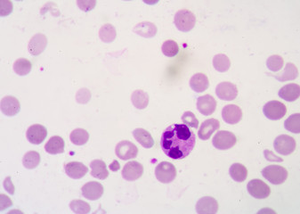 Blood cell formation from bone marrow