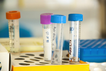 Test tubes stored in a laboratory
