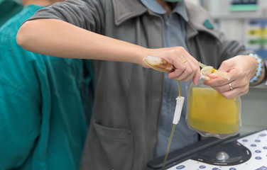 prepare single doner platelet during open heart surgery