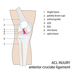 ACL. anterior cruciate ligament. vector format illustration.