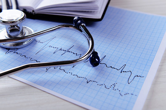 Cardiogram with stethoscope on table, closeup