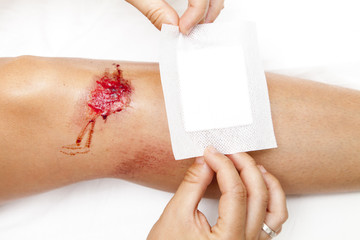 Person with fresh bleeding wounds on the knees The damage is treated with an adhesive bandage, to prevent the blood from flowing. Against white background, closeup