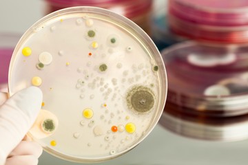 Microbiology, Petri Dish, Biotechnology.
