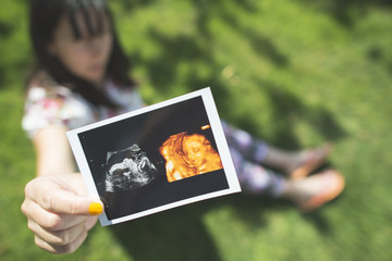 Pregnant women hold picture of womb