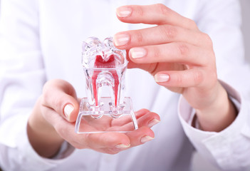 Female hands holding dental model, closeup