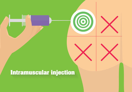 Intramuscular injection vector illustration. Technique of intramuscularrote of administration.