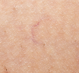 veins on the skin. close