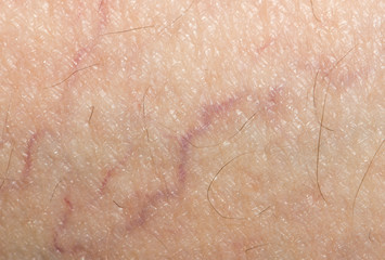 Fototapeta premium veins on the skin. close