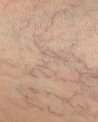 veins on the skin. close