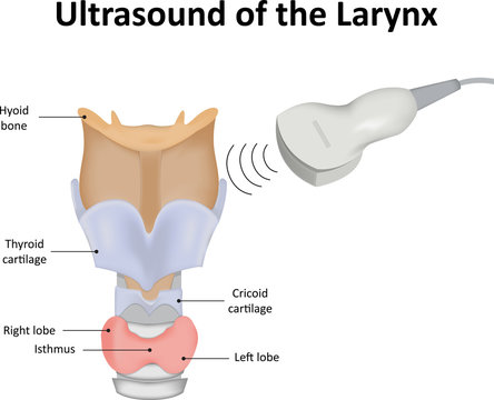 Ultrasound of the Larynx